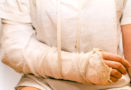 Personal Injury Attorney, Rohnert Park, CA